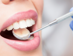 Ensuring the Success of Your Dental Implants in Teddington